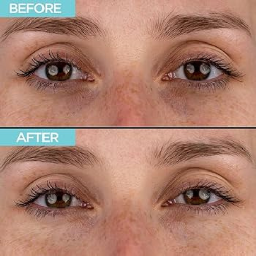 Micro Needling serum eye patches