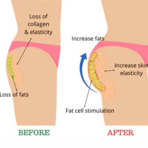 Booty shaping patch